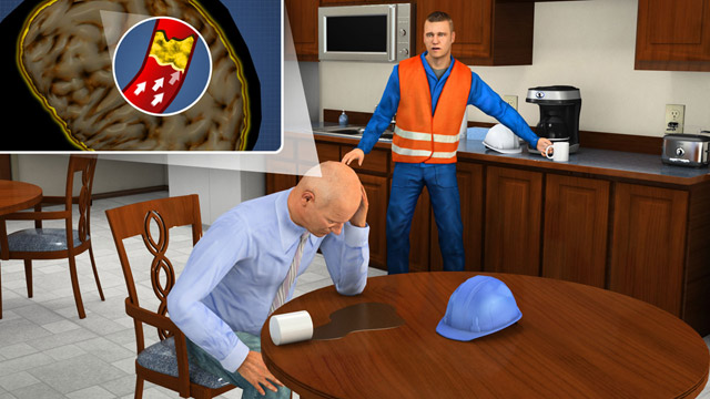 First Aid - Stroke